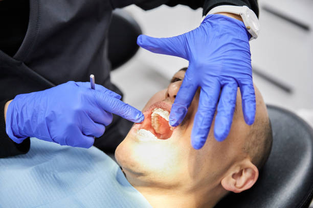 Best Emergency Dental Care for Broken or Chipped Teeth in Ada, MN