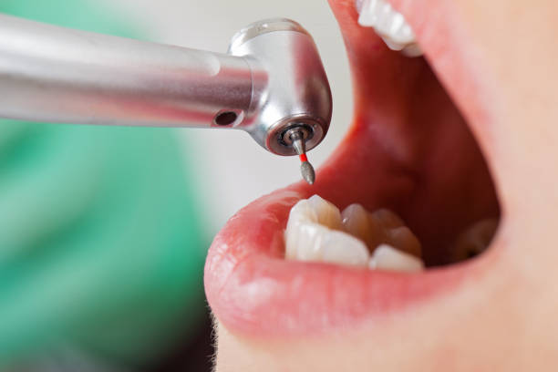 Best Cosmetic Emergency Dentistry in Ada, MN